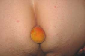 So whos Spotty Apricotty Botty is this?
